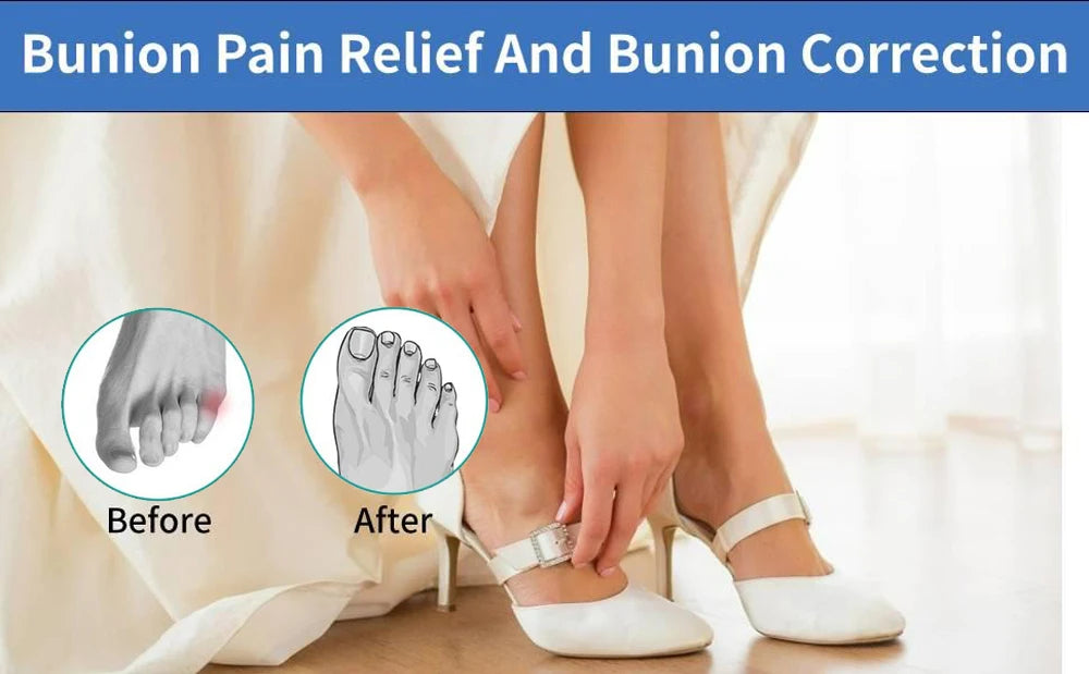 1Pair Tailor Bunion Corrector Pads Splint for Bunion Pinky Toe Relief Toe Straightener, Little Toe Separator  With Anti-Slip