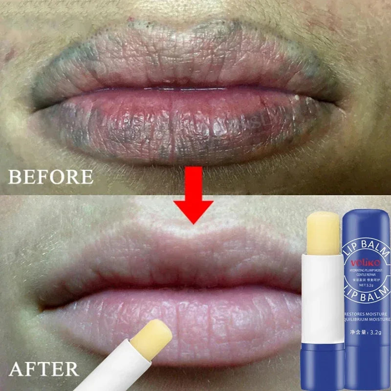 Remove Dark Lip Balm Lighten Melanin Keeping Elasticlip Mask Exfoliating Moisturize Dead Skin Repair Korean Lip Care Products