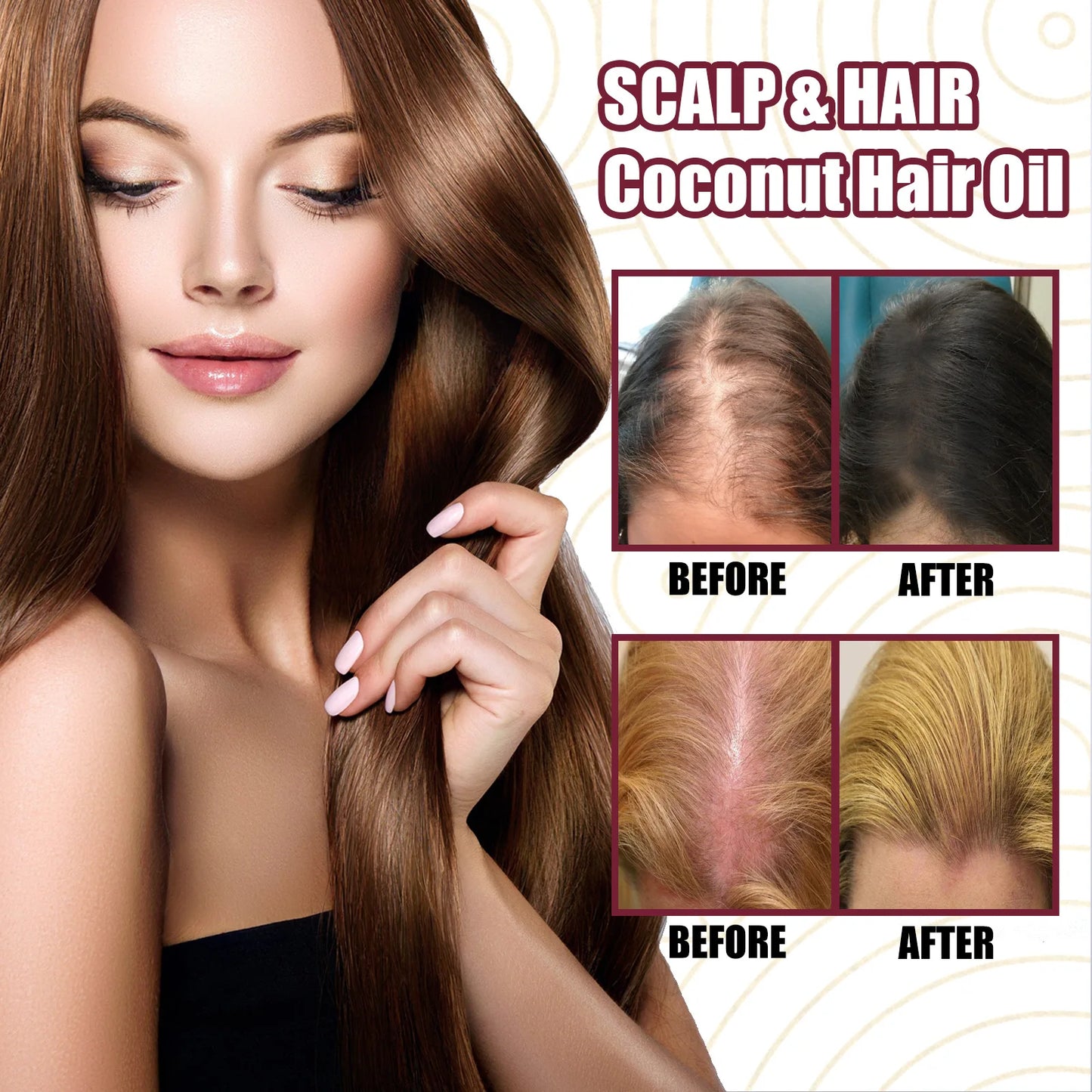 Hair Growth Serum Spray Prevent Hair Loss Scalp Treatment Improve Alopecia Strengthening Anti Dry Frizz Red Onion Essential Oil