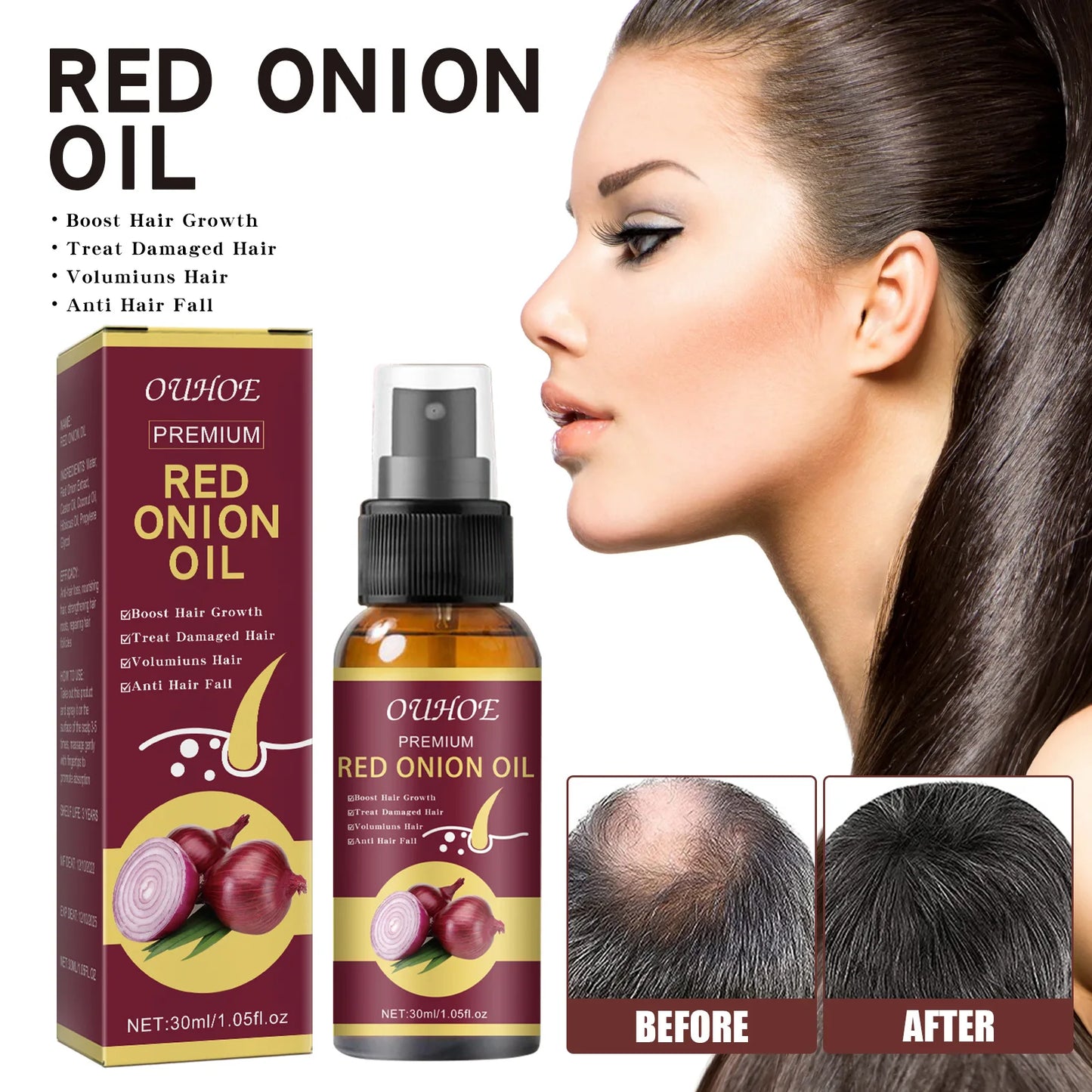 Hair Growth Serum Spray Prevent Hair Loss Scalp Treatment Improve Alopecia Strengthening Anti Dry Frizz Red Onion Essential Oil