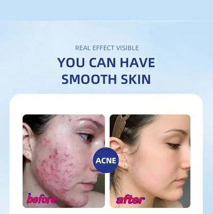 Salicylic Acid  Solution Essence Shrink pores and Acne Spot Removing Shrink Pores Oil-Control Brighten Face Skin Makeup