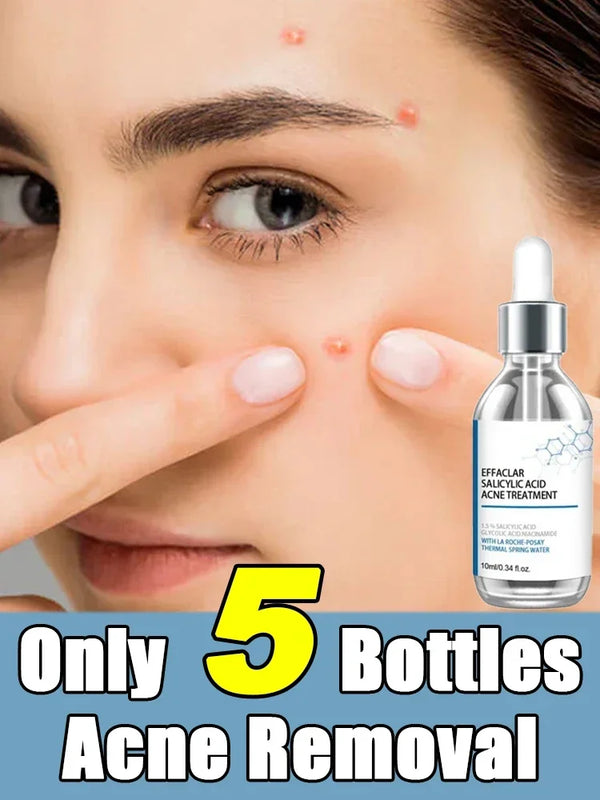 Salicylic Acid  Solution Essence Shrink pores and Acne Spot Removing Shrink Pores Oil-Control Brighten Face Skin Makeup