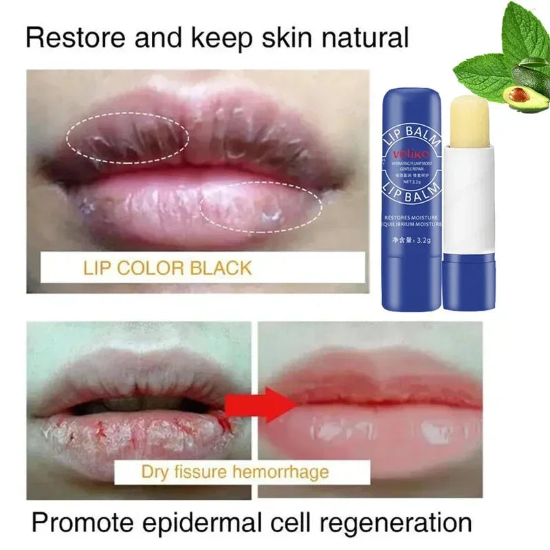 Remove Dark Lip Balm Lighten Melanin Keeping Elasticlip Mask Exfoliating Moisturize Dead Skin Repair Korean Lip Care Products