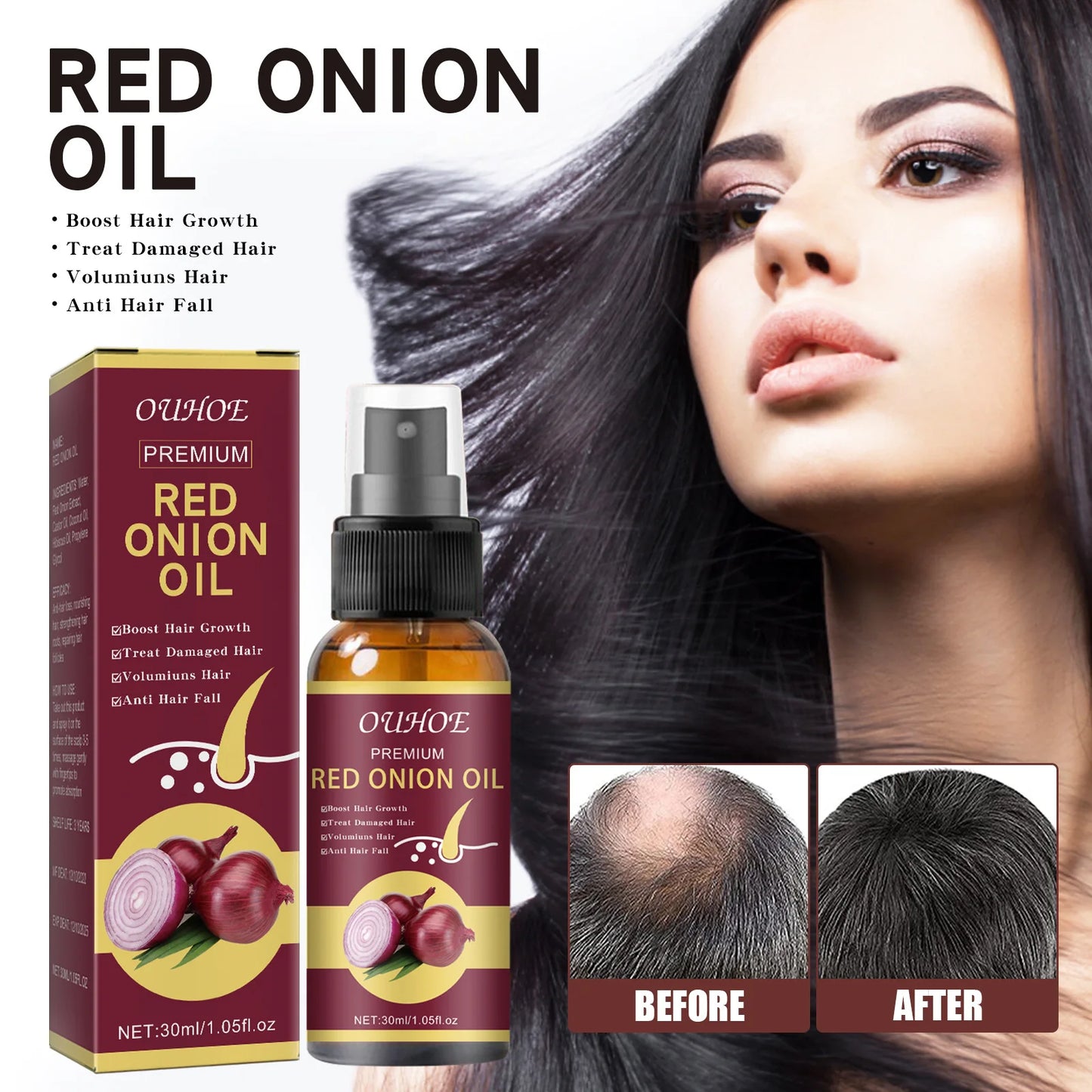 Hair Growth Serum Spray Prevent Hair Loss Scalp Treatment Improve Alopecia Strengthening Anti Dry Frizz Red Onion Essential Oil