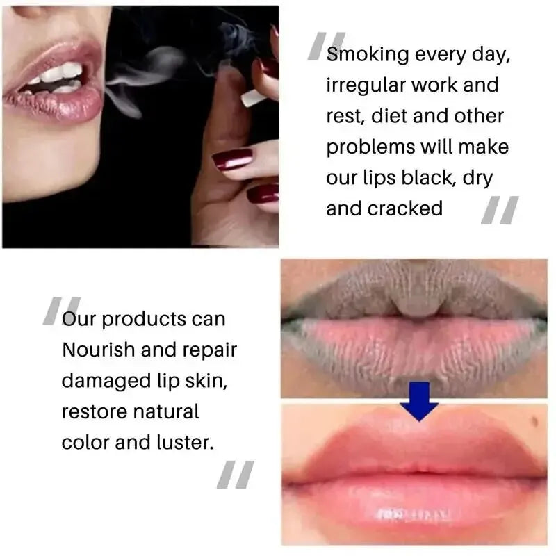 Remove Dark Lip Balm Lighten Melanin Keeping Elasticlip Mask Exfoliating Moisturize Dead Skin Repair Korean Lip Care Products