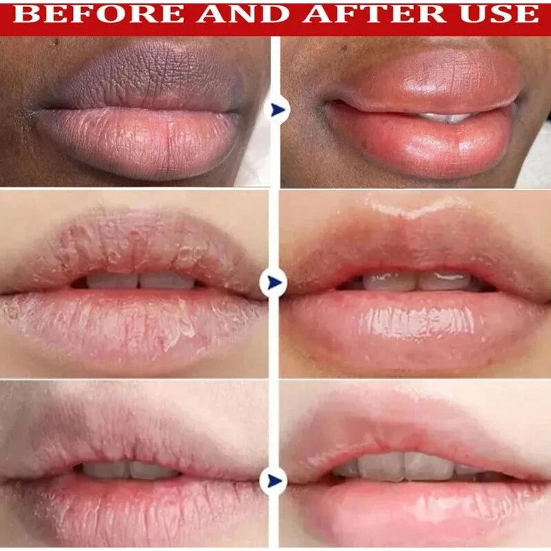 Remove Dark Lip Balm Lighten Melanin Keeping Elasticlip Mask Exfoliating Moisturize Dead Skin Repair Korean Lip Care Products