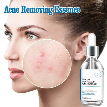 Salicylic Acid  Solution Essence Shrink pores and Acne Spot Removing Shrink Pores Oil-Control Brighten Face Skin Makeup